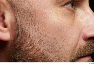  HD Face Skin Neeo bearded cheek face skin pores skin texture 0001.jpg